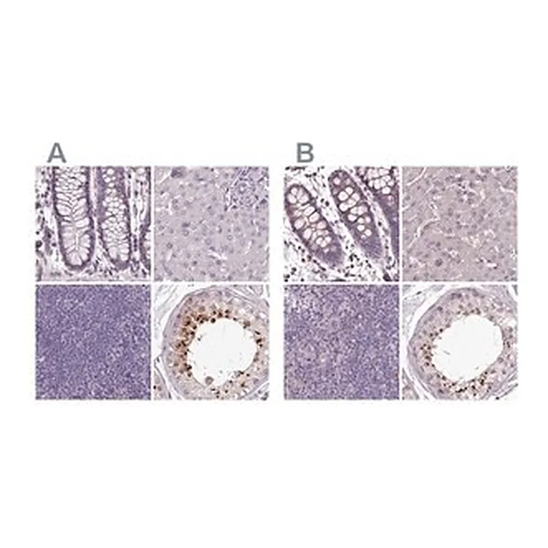 Merck Anti-C1orf56 antibody produced in rabbit