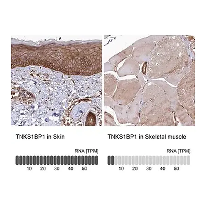 Merck Anti-TNKS1BP1 antibody produced in rabbit