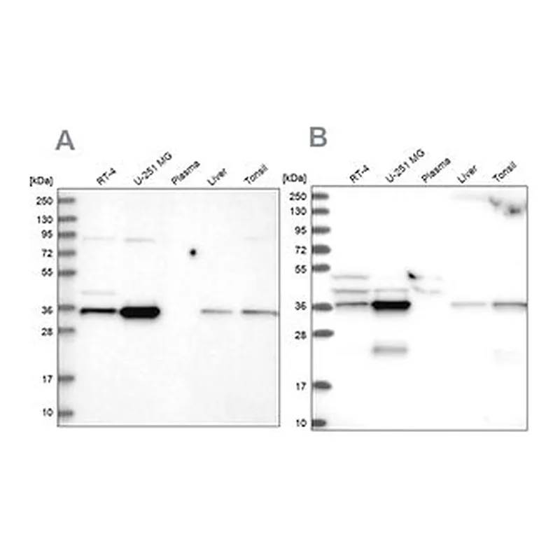 Merck Anti-GPATCH11 antibody produced in rabbit