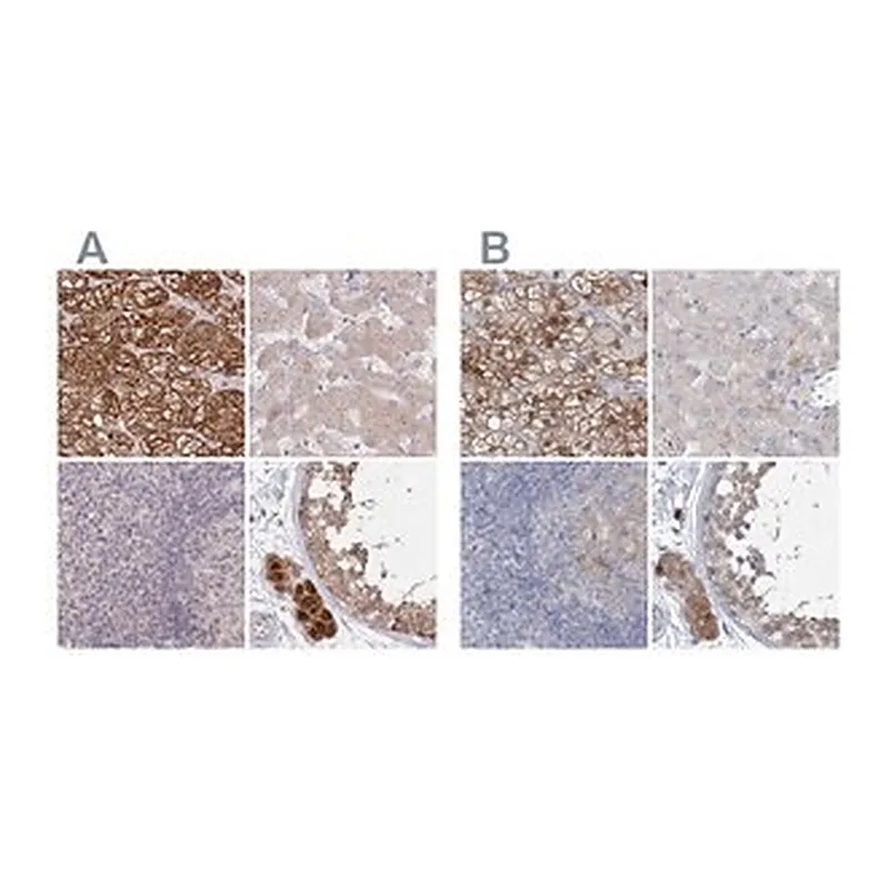 Merck Anti-AAMDC antibody produced in rabbit