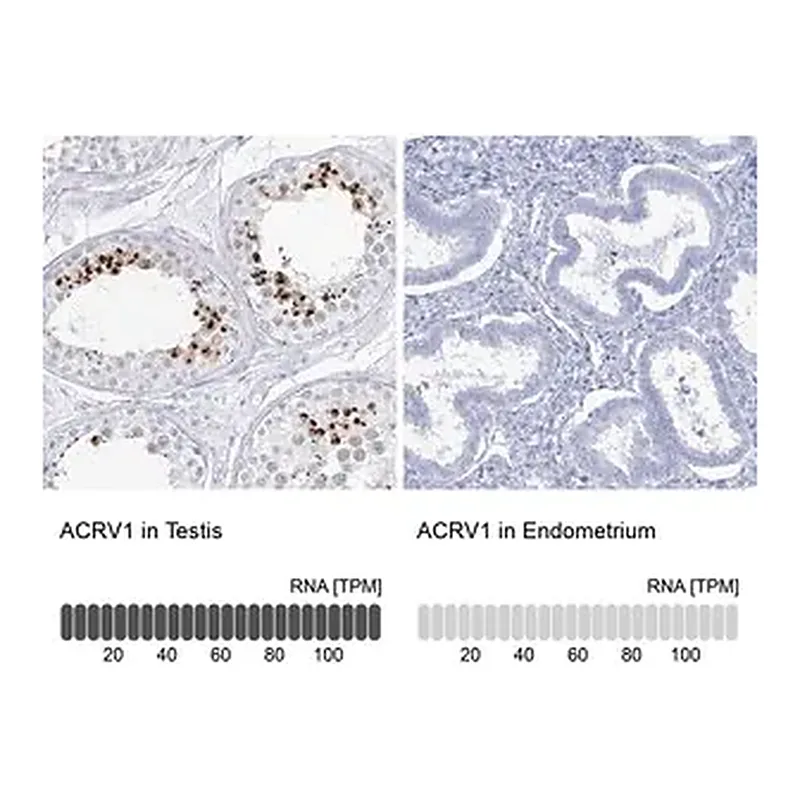 Merck Anti-ACRV1 antibody produced in rabbit