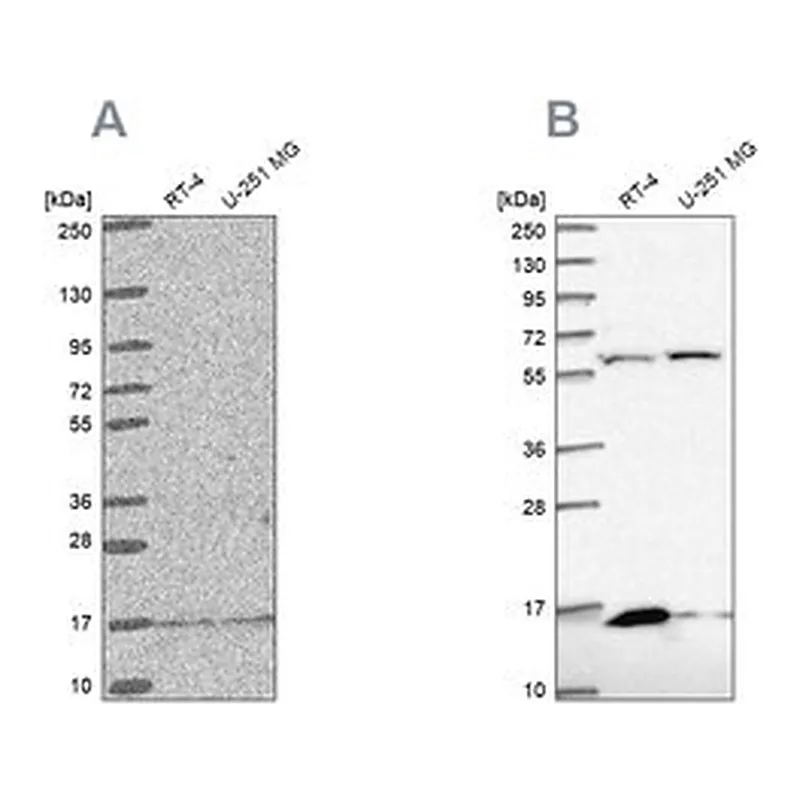 Merck Anti-MRPS16 antibody produced in rabbit
