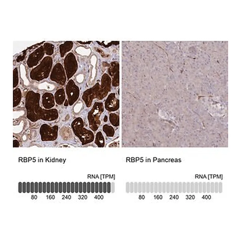 Merck Anti-RBP5 antibody produced in rabbit