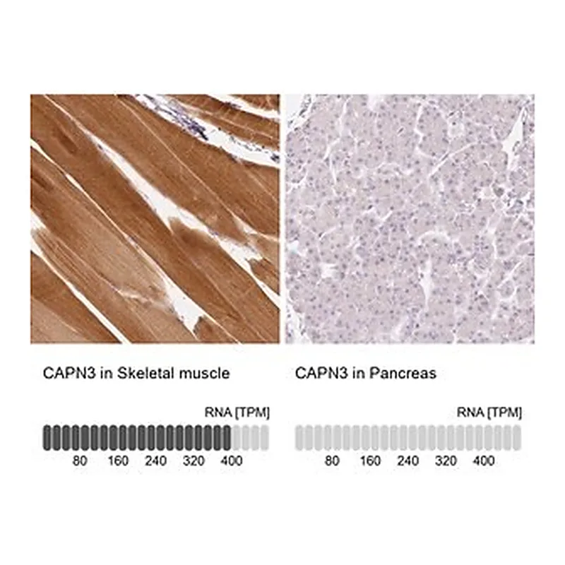 Merck Anti-CAPN3 antibody produced in rabbit