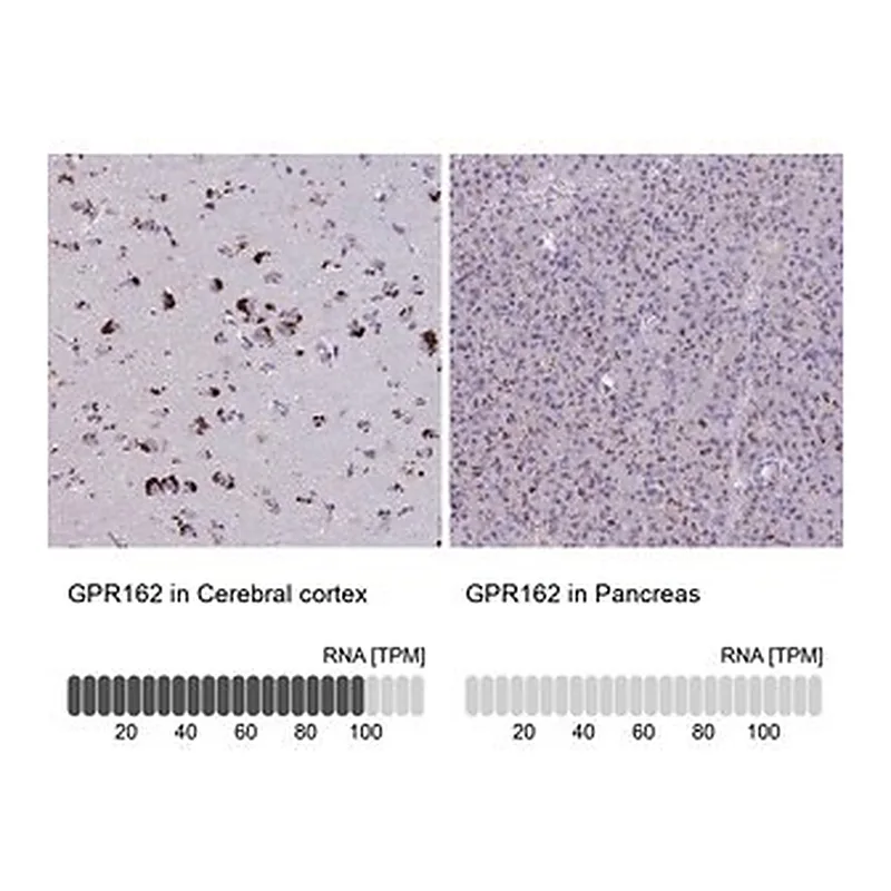 Merck Anti-GPR162 antibody produced in rabbit