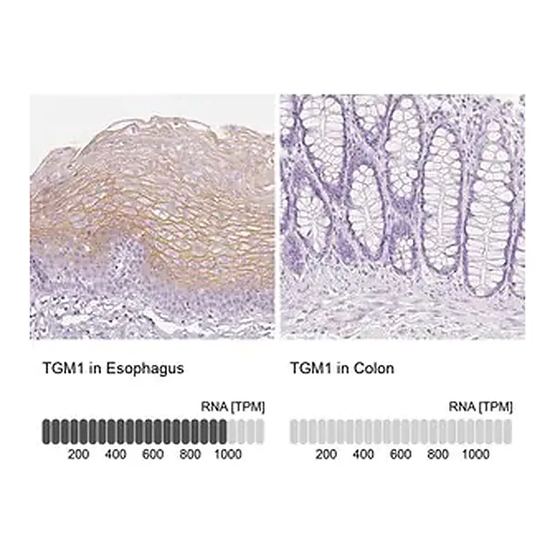 Merck Anti-TGM1 antibody produced in rabbit