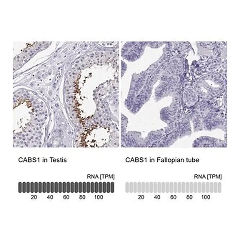 Merck Anti-CABS1 antibody produced in rabbit