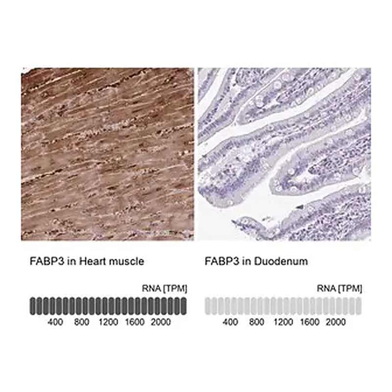 Merck Anti-FABP3 antibody produced in rabbit