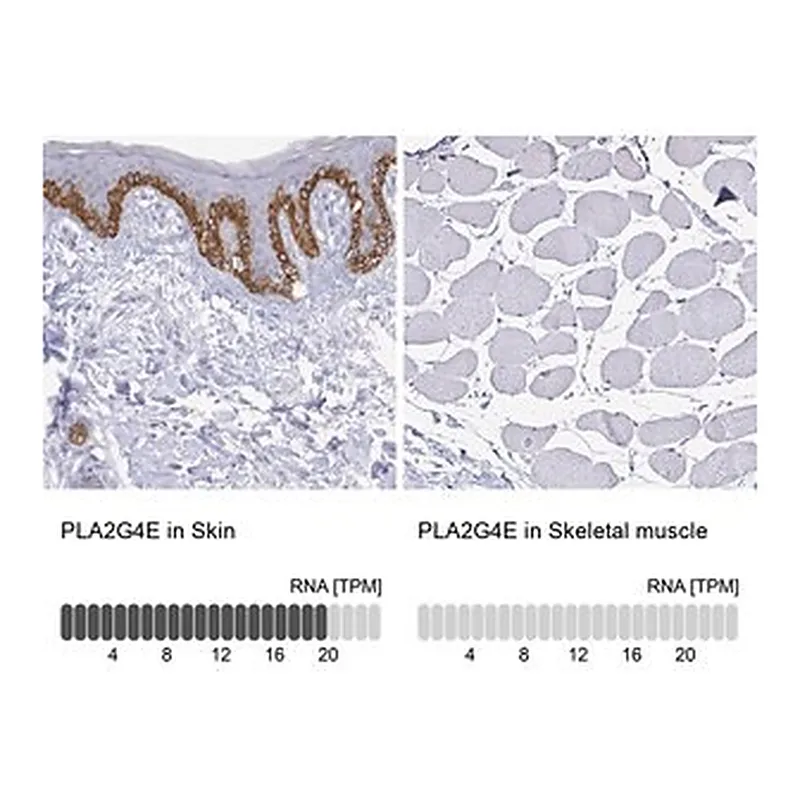 Merck Anti-PLA2G4E antibody produced in rabbit