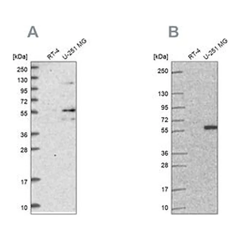 Merck Anti-ACSBG1 antibody produced in rabbit