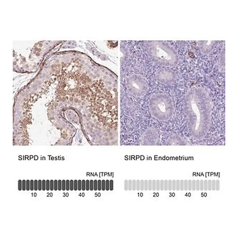Merck Anti-SIRPD antibody produced in rabbit