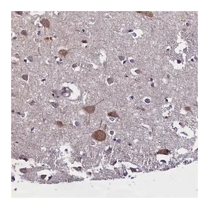 Merck Anti-ABCC8 antibody produced in rabbit