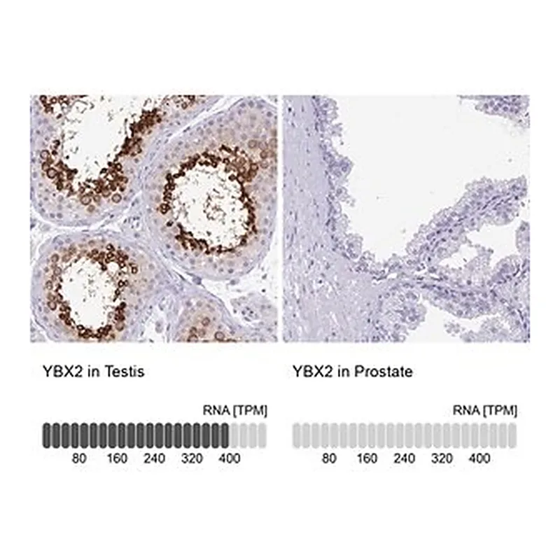 Merck Anti-YBX2 antibody produced in rabbit