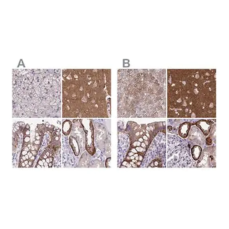 Merck Anti-EPB41L1 antibody produced in rabbit