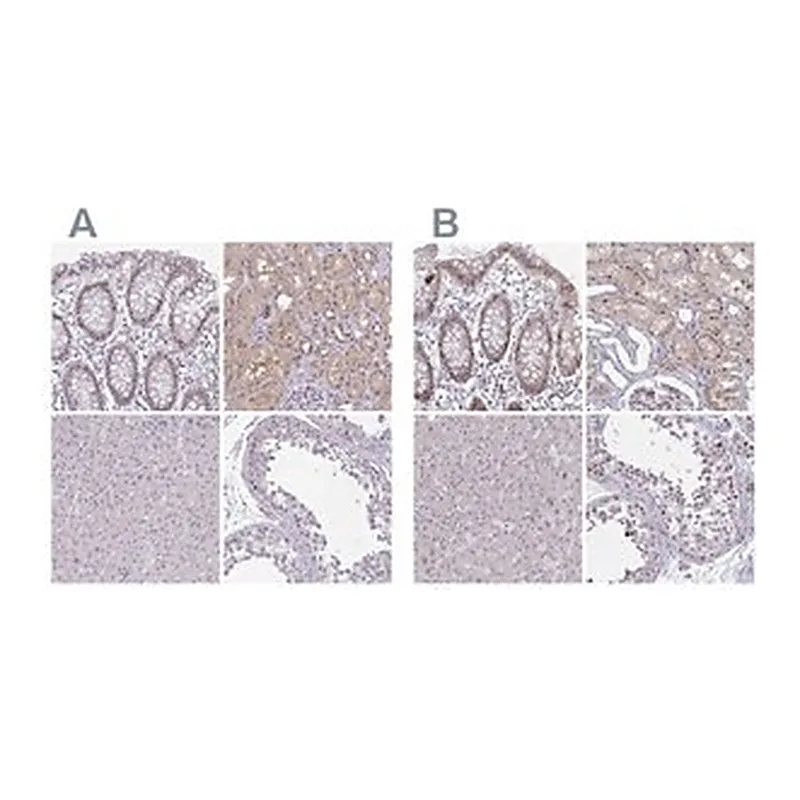 Merck Anti-RBL1 antibody produced in rabbit