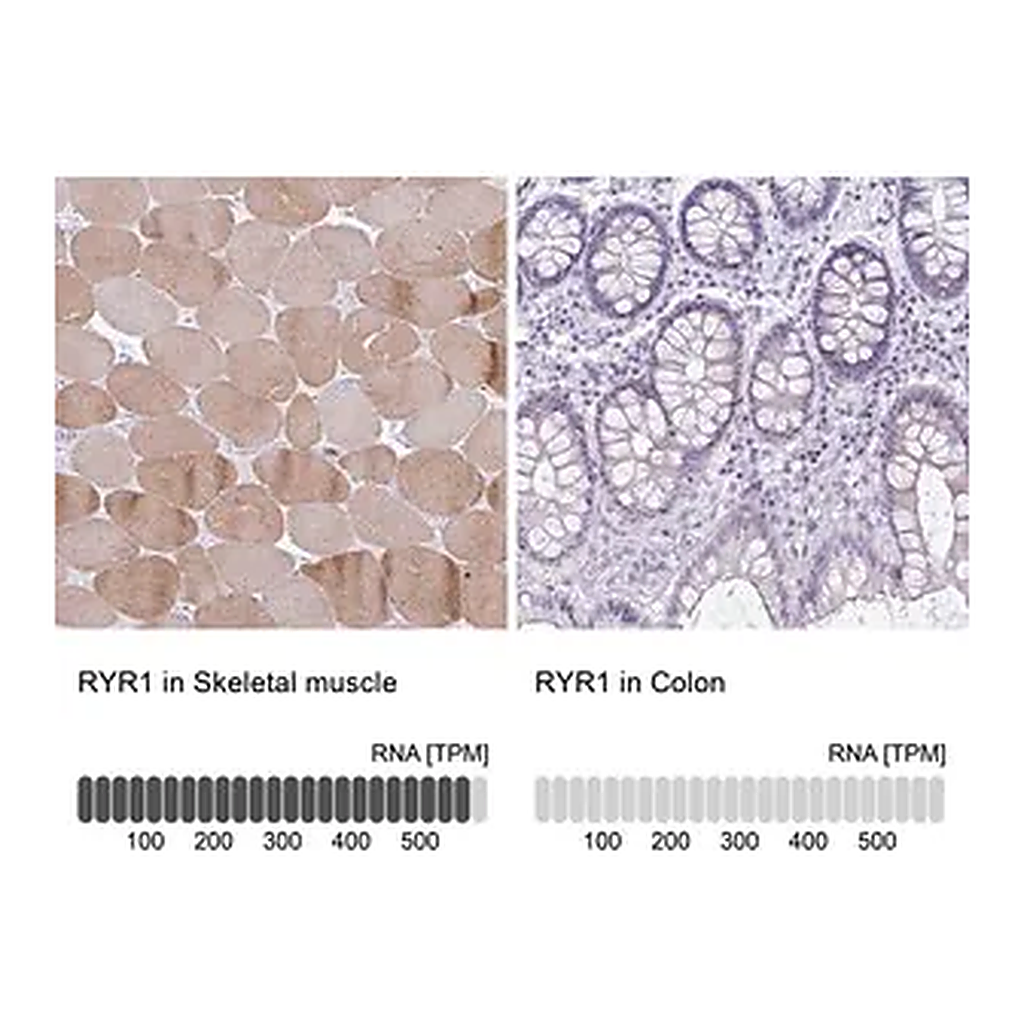 Merck Anti-RYR1 antibody produced in rabbit