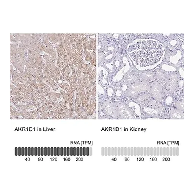 Merck Anti-AKR1D1 antibody produced in rabbit