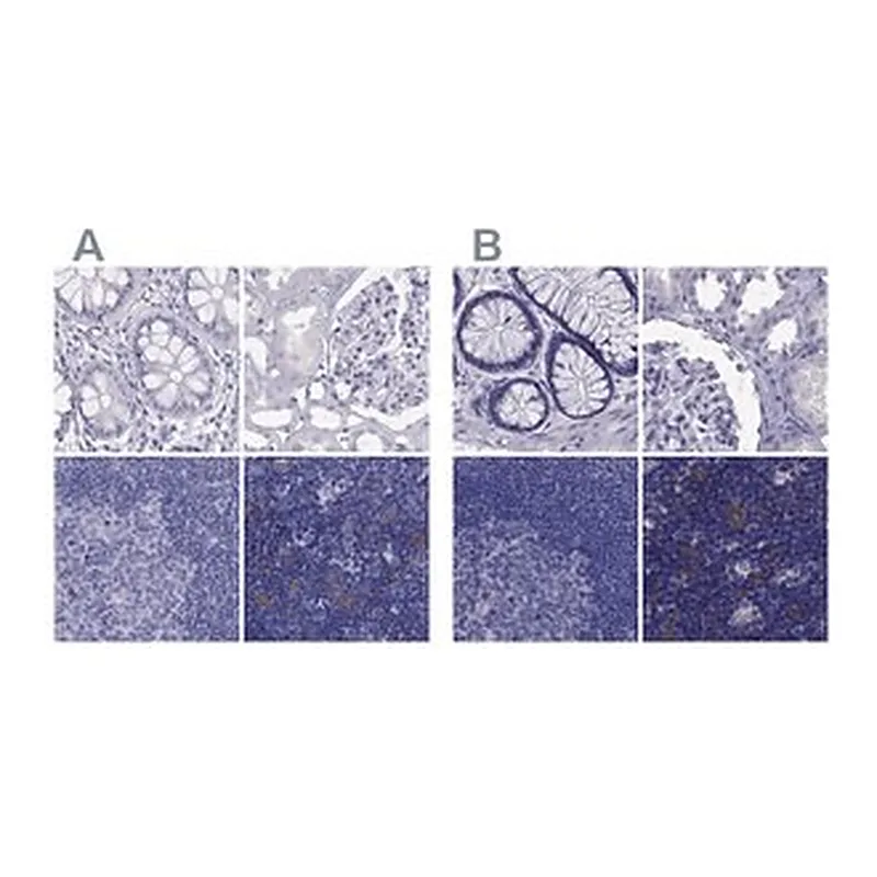 Merck Anti-PSMB11 antibody produced in rabbit