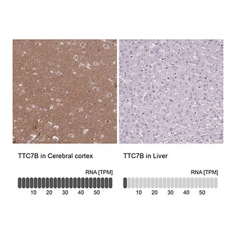 Merck Anti-TTC7B antibody produced in rabbit