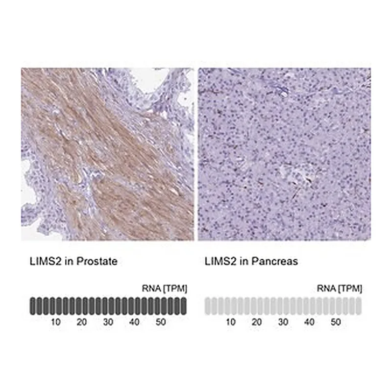 Merck Anti-LIMS2 antibody produced in rabbit