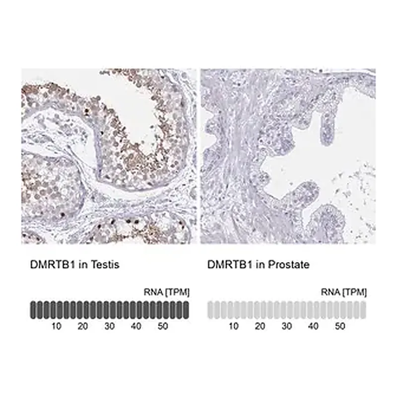 Merck Anti-DMRTB1 antibody produced in rabbit