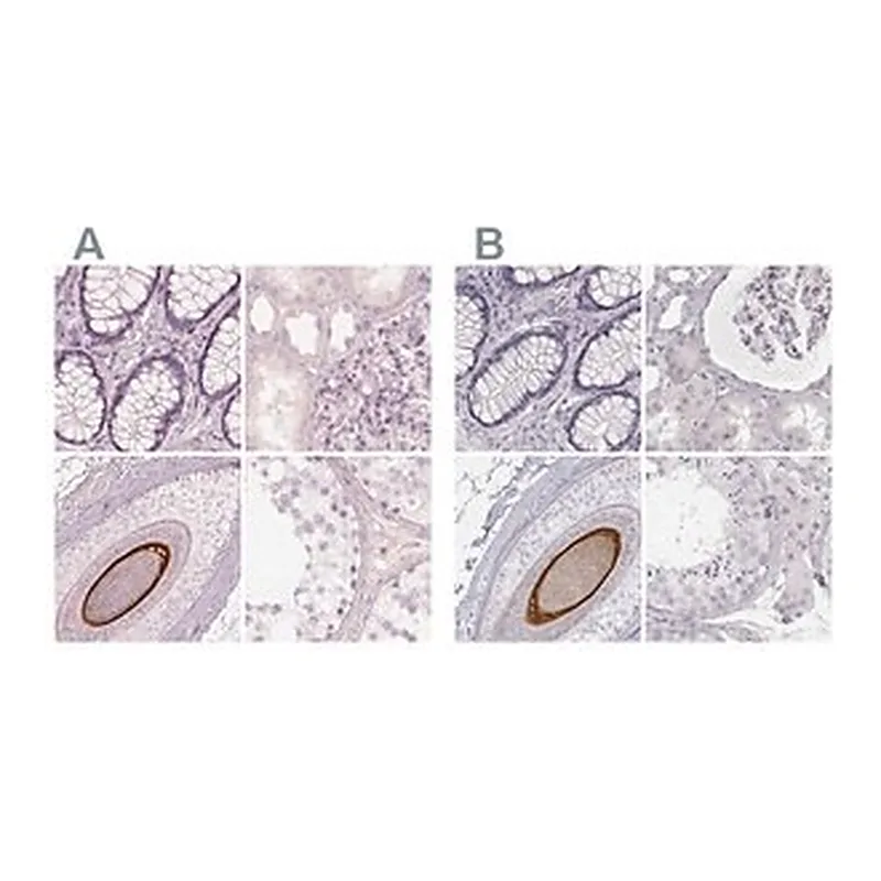 Merck Anti-KRT82 antibody produced in rabbit