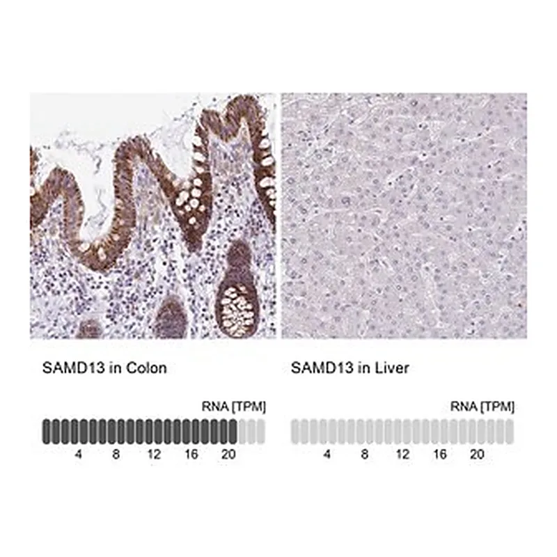 Merck Anti-SAMD13 antibody produced in rabbit