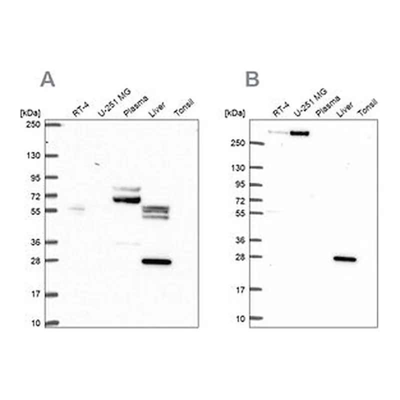 Merck Anti-QDPR antibody produced in rabbit