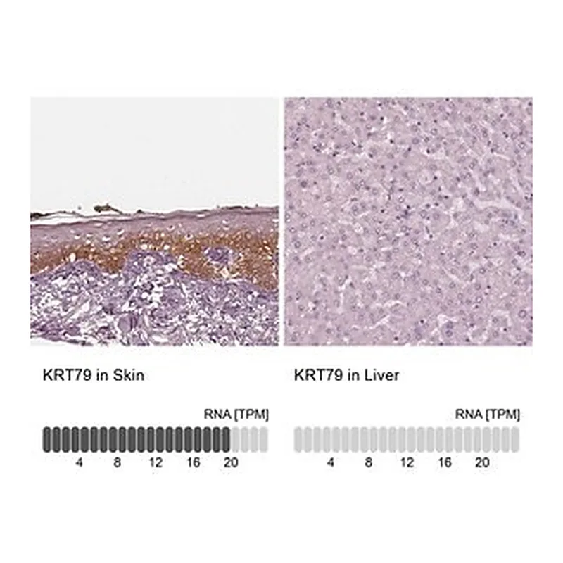 Merck Anti-KRT79 antibody produced in rabbit