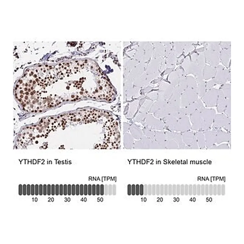 Merck Anti-YTHDF2 antibody produced in rabbit