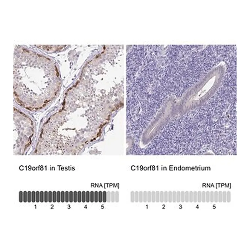 Merck Anti-C19orf81 antibody produced in rabbit