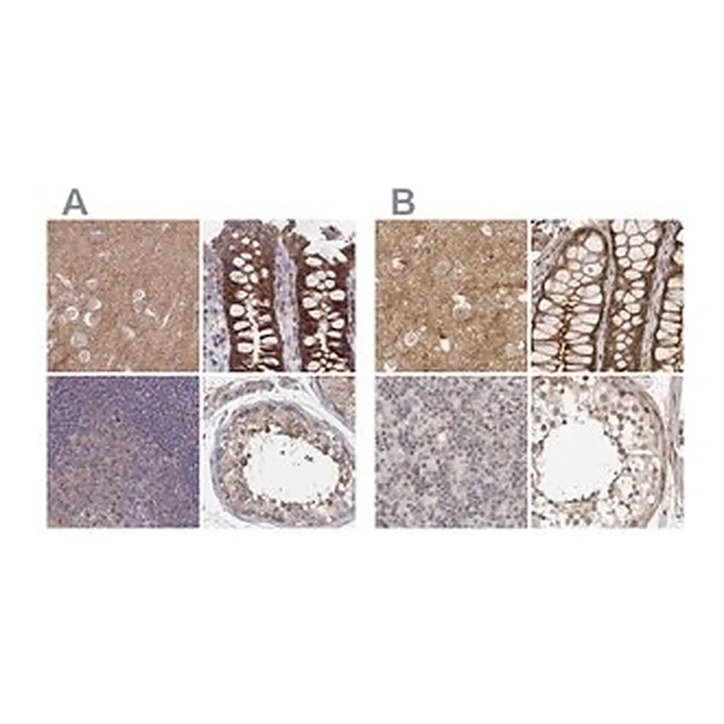 Merck Anti-SORBS1 antibody produced in rabbit