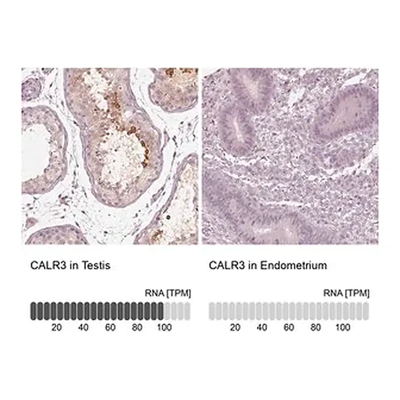 Merck Anti-CALR3 antibody produced in rabbit