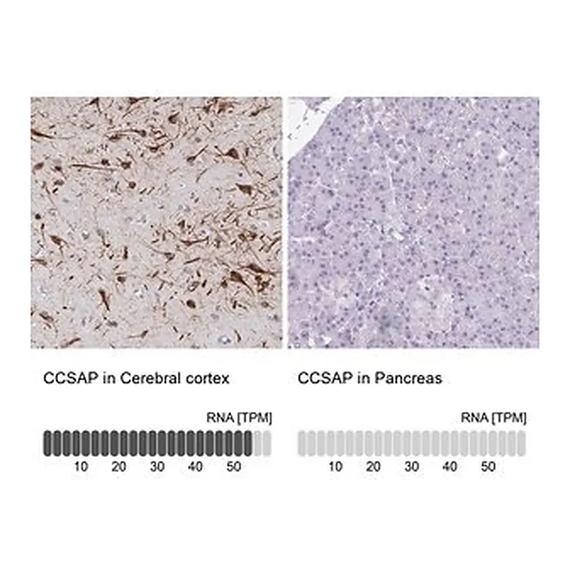 Merck Anti-CCSAP antibody produced in rabbit