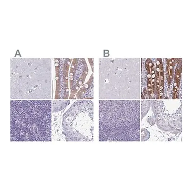 Merck Anti-PLCB3 antibody produced in rabbit