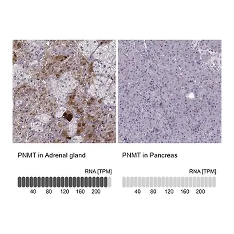 Merck Anti-PNMT antibody produced in rabbit