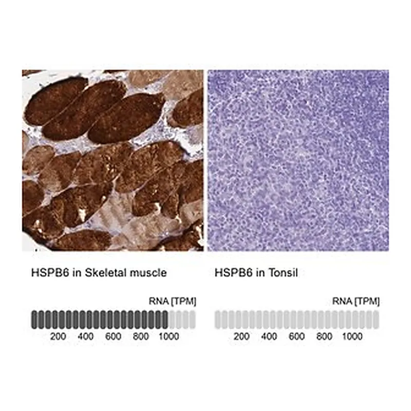 Merck Anti-HSPB6 antibody produced in rabbit