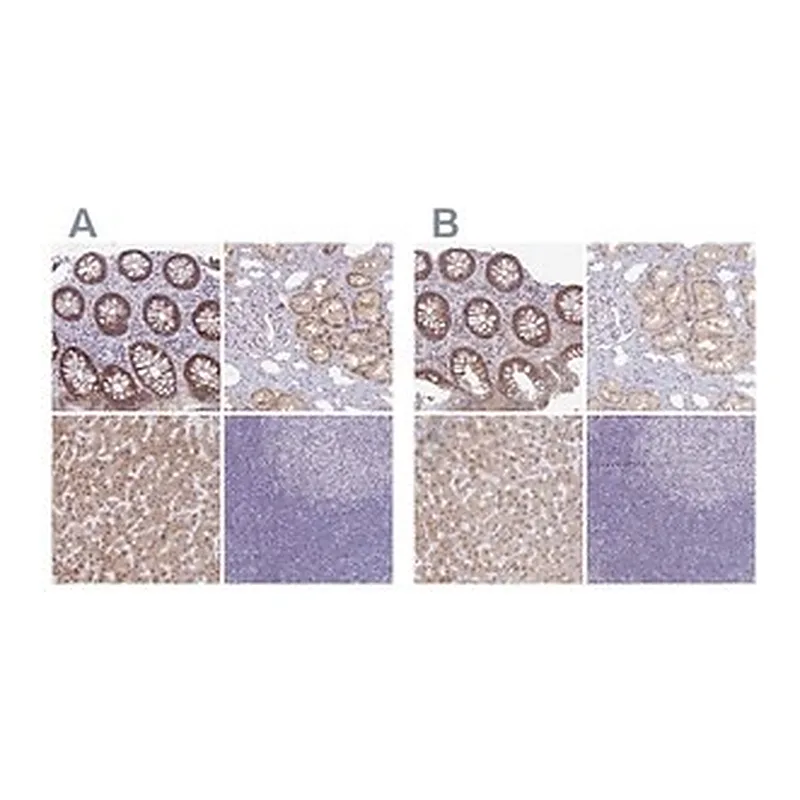 Merck Anti-A1CF antibody produced in rabbit