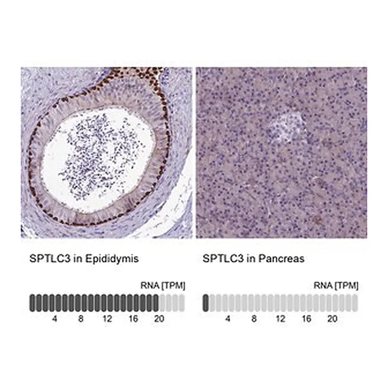 Merck Anti-SPTLC3 antibody produced in rabbit