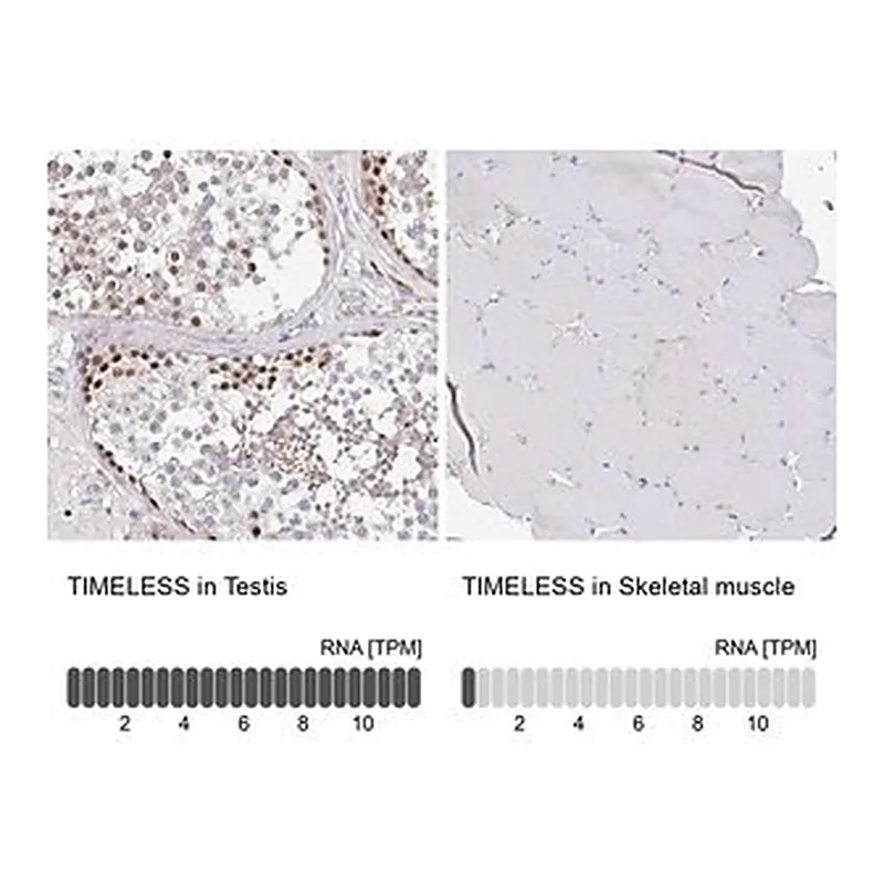 Merck Anti-TIMELESS antibody produced in rabbit
