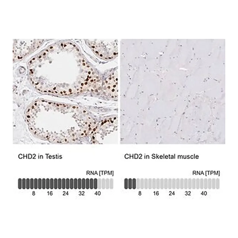 Merck Anti-CHD2 antibody produced in rabbit
