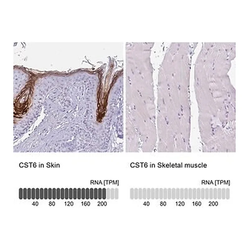 Merck Anti-CST6 antibody produced in rabbit