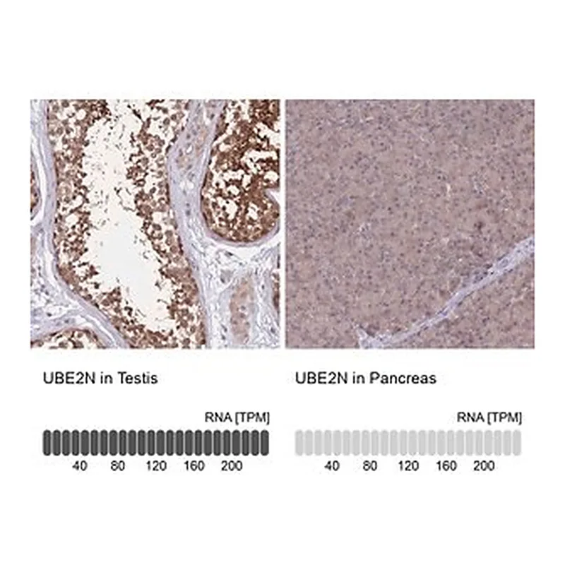 Merck Anti-UBE2N antibody produced in rabbit