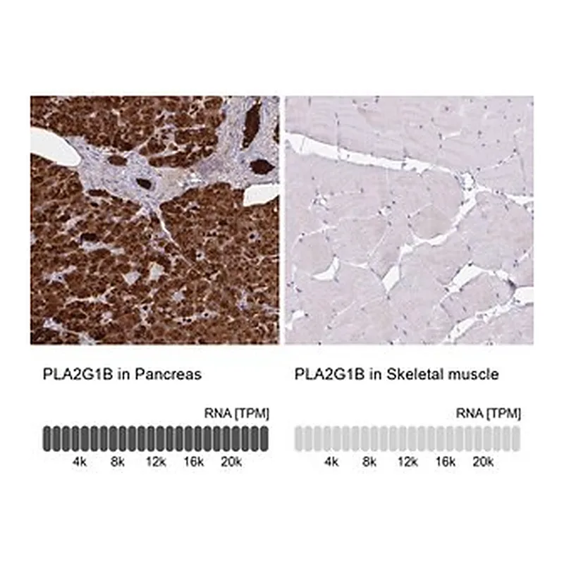 Merck Anti-PLA2G1B antibody produced in rabbit
