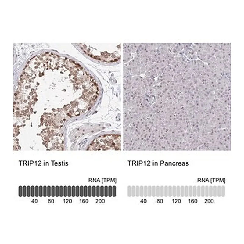 Merck Anti-TRIP12 antibody produced in rabbit