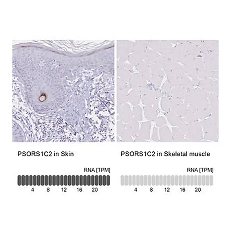 Merck Anti-PSORS1C2 antibody produced in rabbit