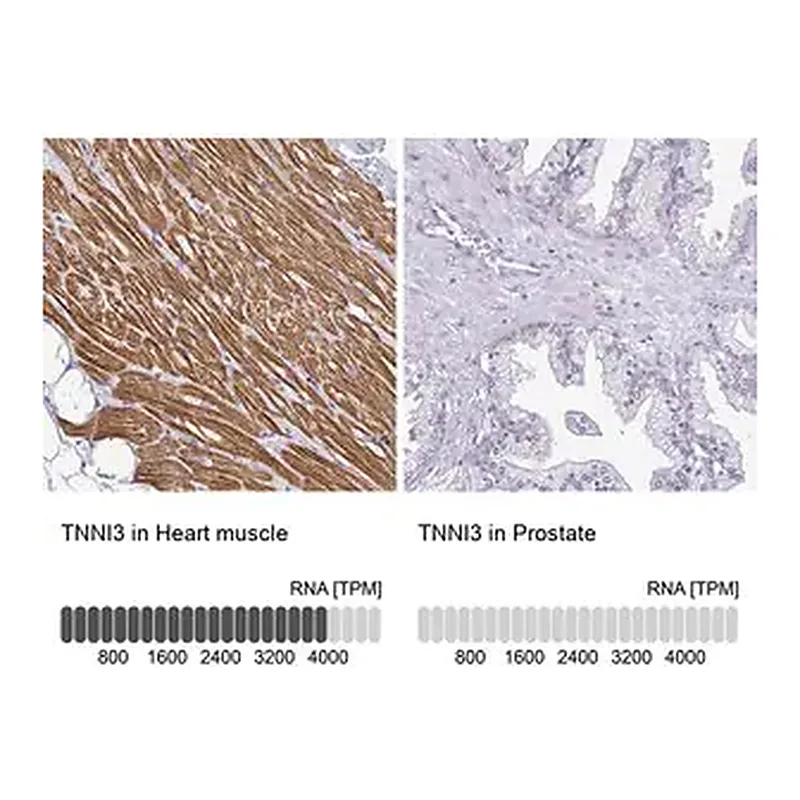 Merck Anti-TNNI3 antibody produced in rabbit