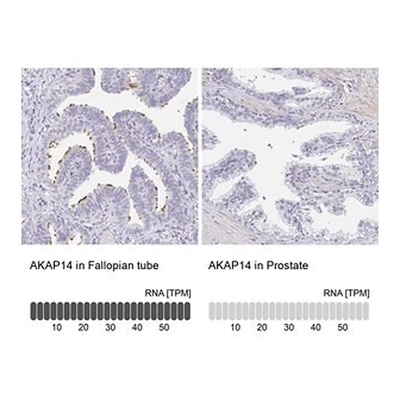 Merck Anti-AKAP14 antibody produced in rabbit