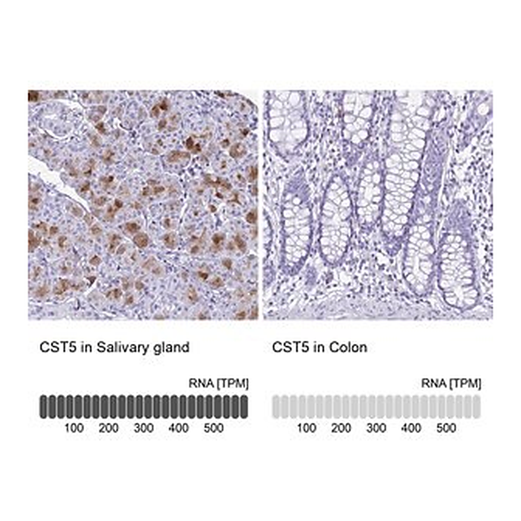Merck Anti-CST5 antibody produced in rabbit
