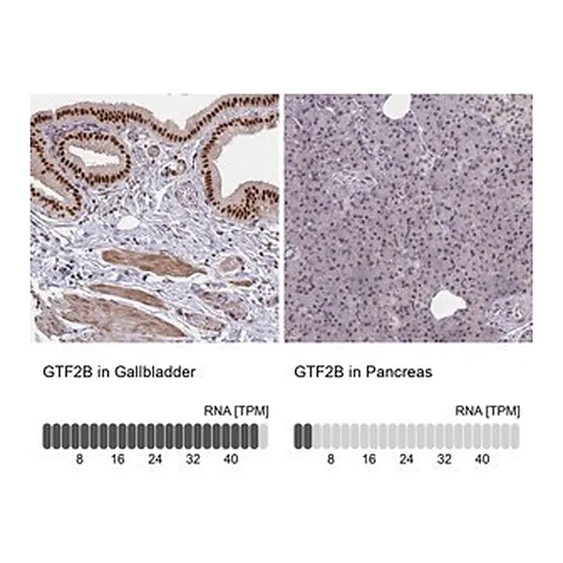 Merck Anti-GTF2B antibody produced in rabbit